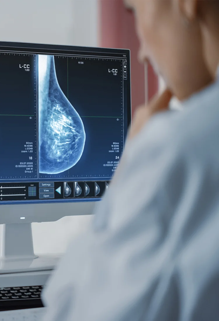 Advanced Breast Cancer